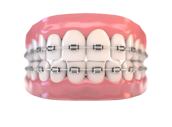 Image of Brackets